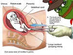 abortion clamp cross_section crying crying_wojak diagram future_scab hat label pepe red_star scab smug wojak // 788x600 // 522KB